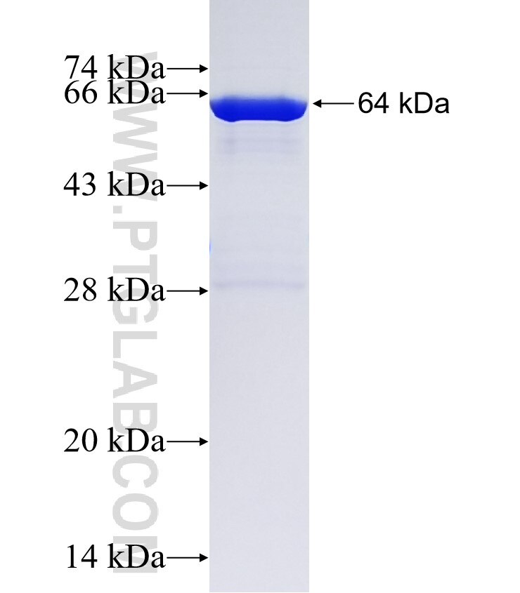 ARMC6 fusion protein Ag22278 SDS-PAGE