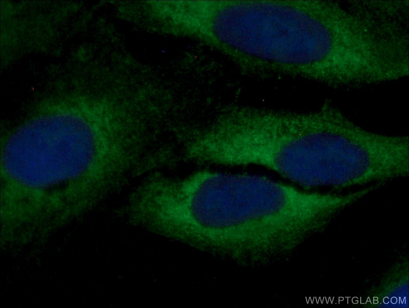 Immunofluorescence (IF) / fluorescent staining of U2OS cells using ARMC7 Polyclonal antibody (24029-1-AP)
