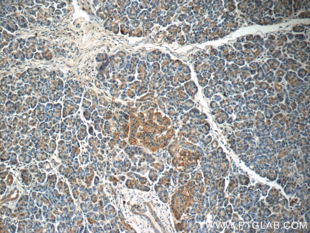 Immunohistochemistry (IHC) staining of human pancreas tissue using ARMC7 Polyclonal antibody (24029-1-AP)