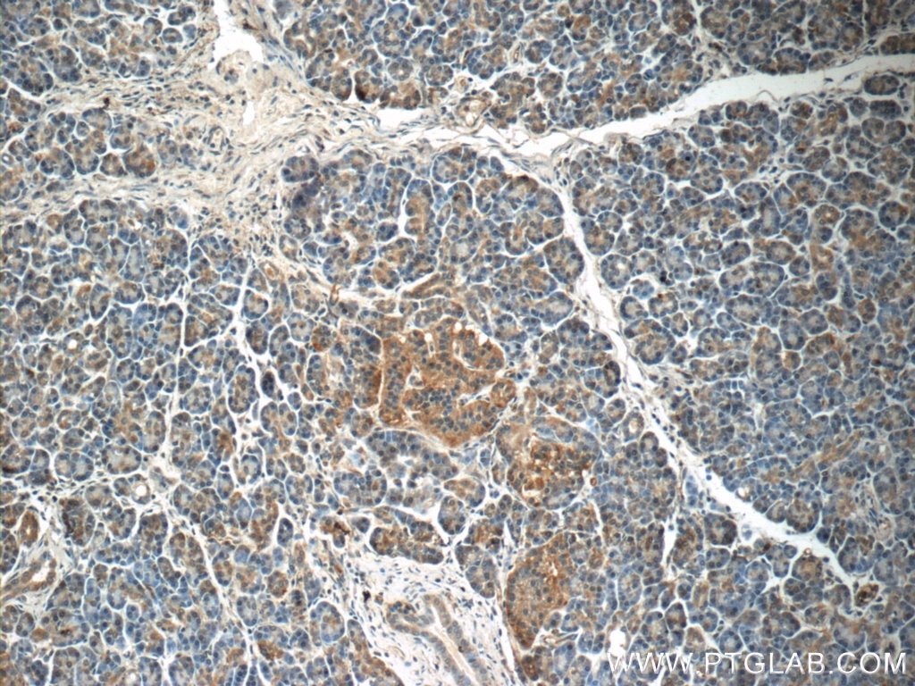 IHC staining of human pancreas using 24029-1-AP