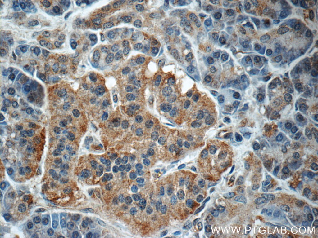 Immunohistochemistry (IHC) staining of human pancreas tissue using ARMC7 Polyclonal antibody (24029-1-AP)