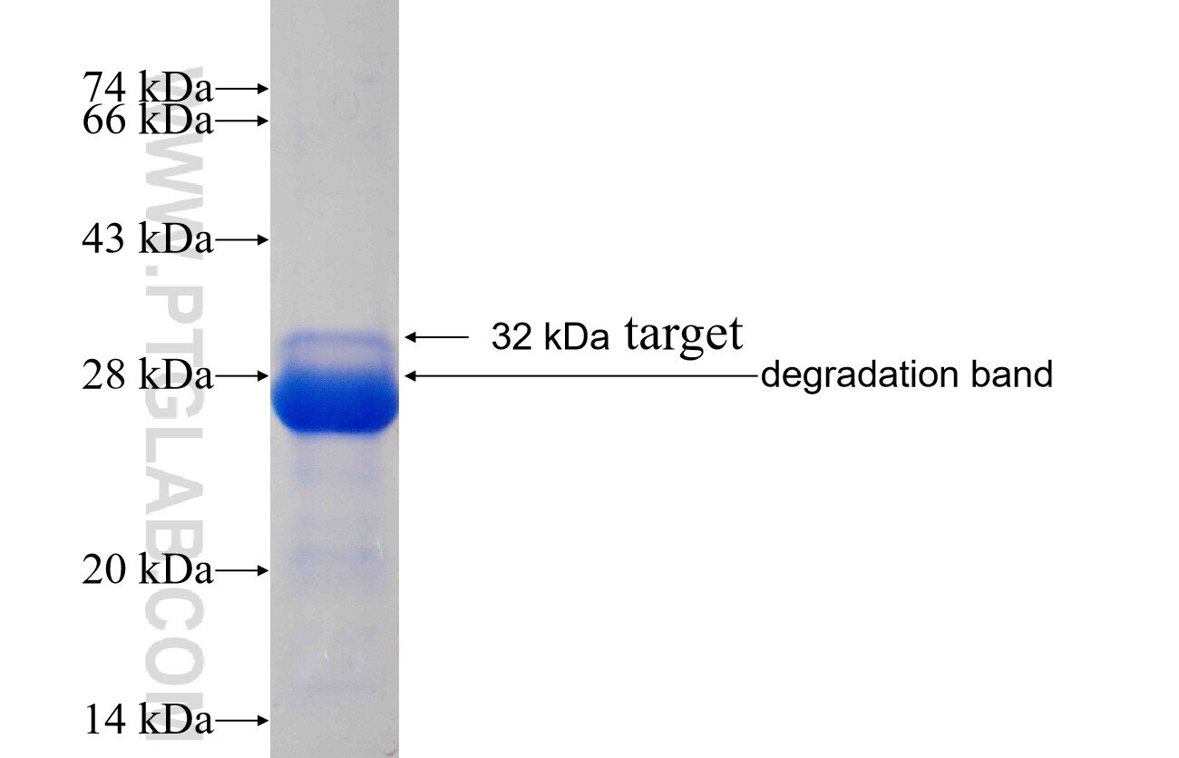 ARMC7 fusion protein Ag21179 SDS-PAGE