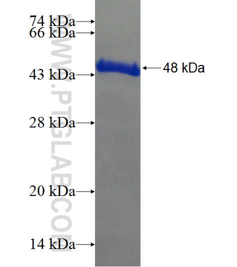 ARMC7 fusion protein Ag21222 SDS-PAGE