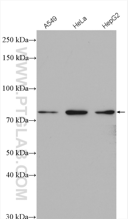 Western Blot (WB) analysis of various lysates using ARMC8 Polyclonal antibody (12653-1-AP)