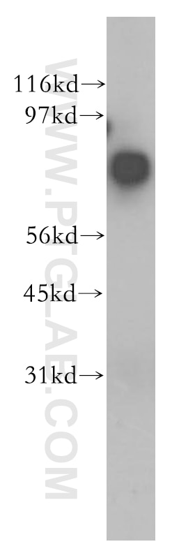 Western Blot (WB) analysis of HeLa cells using ARMC8 Polyclonal antibody (12653-1-AP)