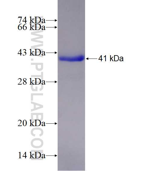 ARMC8 fusion protein Ag28638 SDS-PAGE