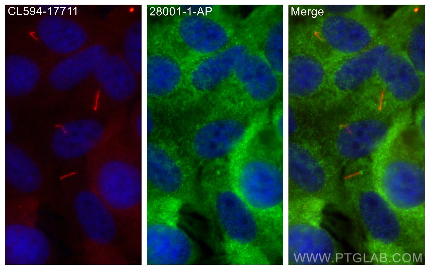 Immunofluorescence (IF) / fluorescent staining of hTERT-RPE1 cells using ARMC9 Polyclonal antibody (28001-1-AP)