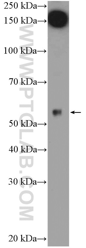 Western Blot (WB) analysis of mouse pancreas tissue using ARMCX1 Polyclonal antibody (20193-1-AP)