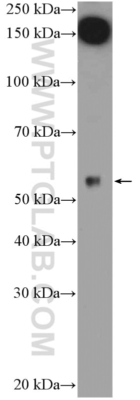 WB analysis of mouse pancreas using 20193-1-AP