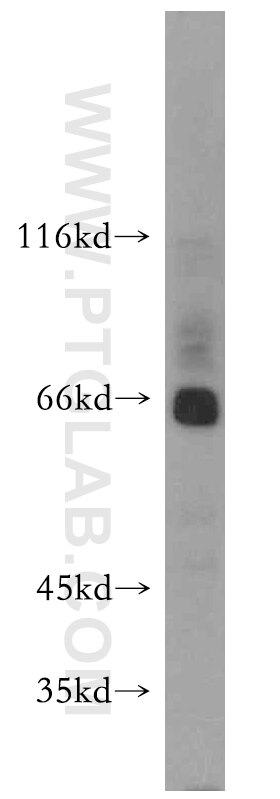 Western Blot (WB) analysis of mouse testis tissue using ARMCX2 Polyclonal antibody (12200-1-AP)