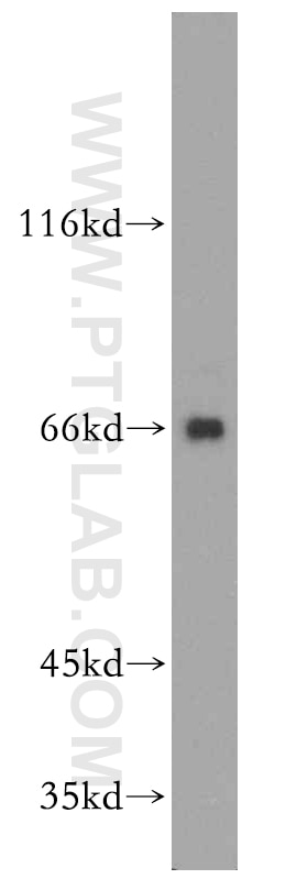 Western Blot (WB) analysis of HEK-293 cells using ARMCX2 Polyclonal antibody (12200-1-AP)