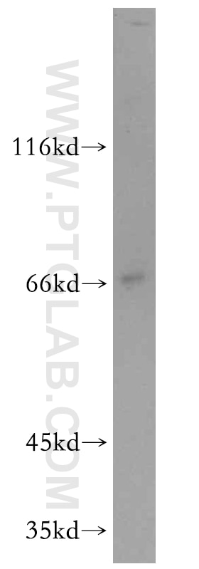 Western Blot (WB) analysis of mouse brain tissue using ARMCX2 Polyclonal antibody (12200-1-AP)