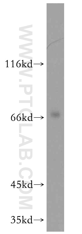Western Blot (WB) analysis of mouse brain tissue using ARMCX2 Polyclonal antibody (12200-1-AP)