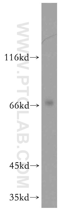 WB analysis of mouse brain using 12200-1-AP