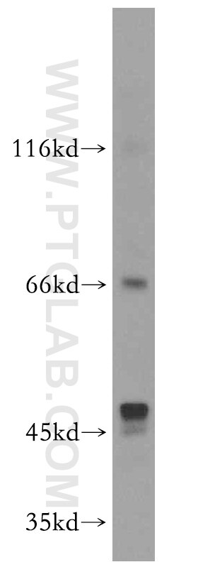 Western Blot (WB) analysis of mouse liver tissue using ARMCX2 Polyclonal antibody (12200-1-AP)