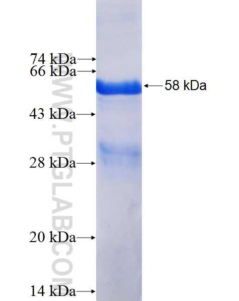 ARMCX2 fusion protein Ag2839 SDS-PAGE