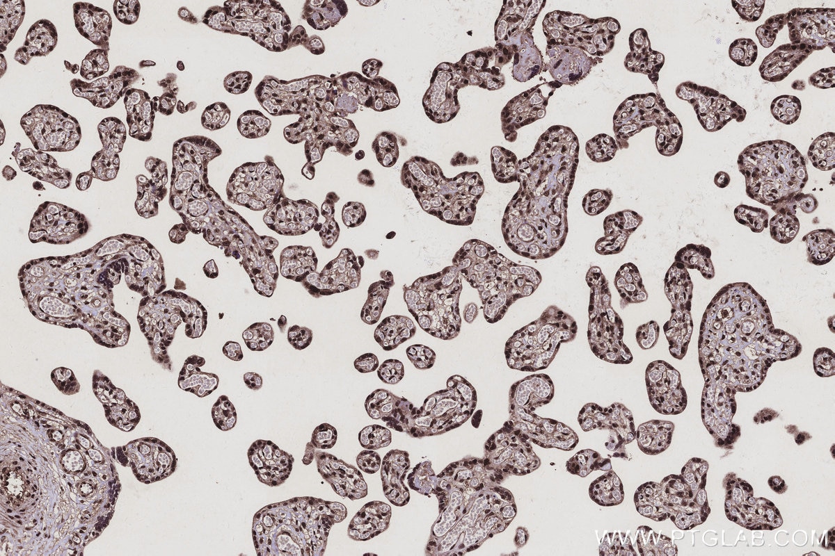 Immunohistochemistry (IHC) staining of human placenta tissue using ARMCX3 Polyclonal antibody (25705-1-AP)