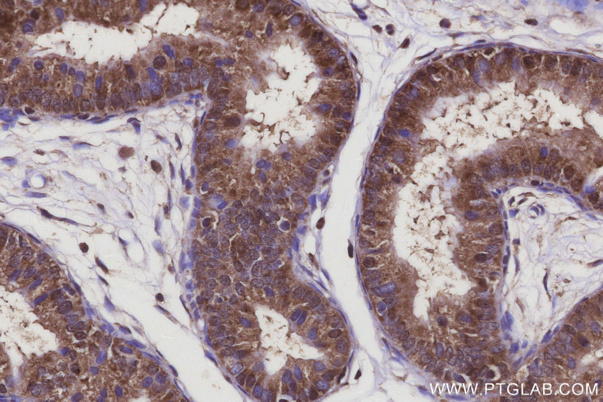 Immunohistochemistry (IHC) staining of rat epididymis tissue using ARMCX3 Polyclonal antibody (25705-1-AP)