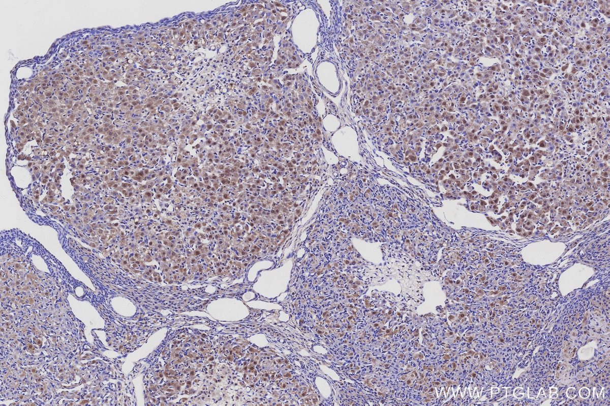 Immunohistochemistry (IHC) staining of rat ovary tissue using ARMCX3 Polyclonal antibody (25705-1-AP)