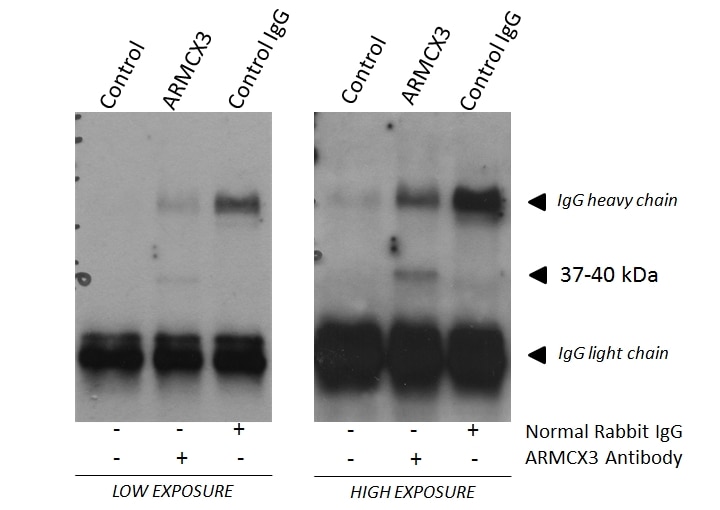 IP experiment of fetal human brain using 25705-1-AP