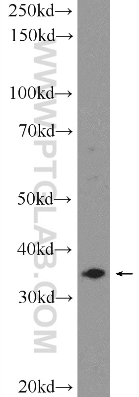 Western Blot (WB) analysis of mouse brain tissue using ARMCX3 Polyclonal antibody (25705-1-AP)