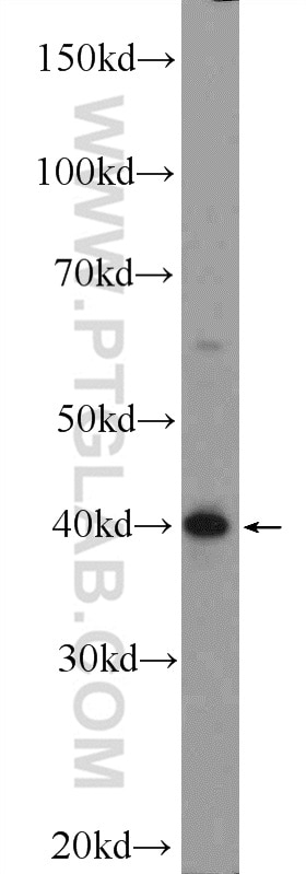 Western Blot (WB) analysis of mouse brain tissue using ARMCX3 Polyclonal antibody (25705-1-AP)