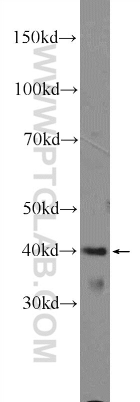 Western Blot (WB) analysis of mouse brain tissue using ARMCX3 Polyclonal antibody (25705-1-AP)