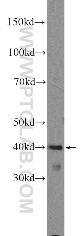 Western Blot (WB) analysis of mouse brain tissue using ARMCX3 Polyclonal antibody (25705-1-AP)