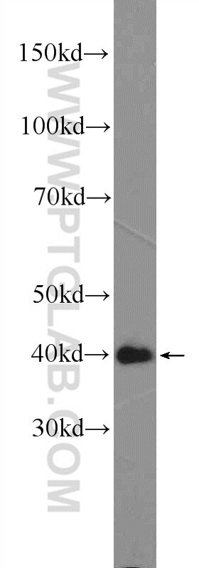 Western Blot (WB) analysis of mouse brain tissue using ARMCX3 Polyclonal antibody (25705-1-AP)