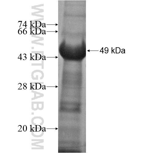 ARMCX6 fusion protein Ag15140 SDS-PAGE ARMCX6 fusion protein Ag15140 SDS-PAGE