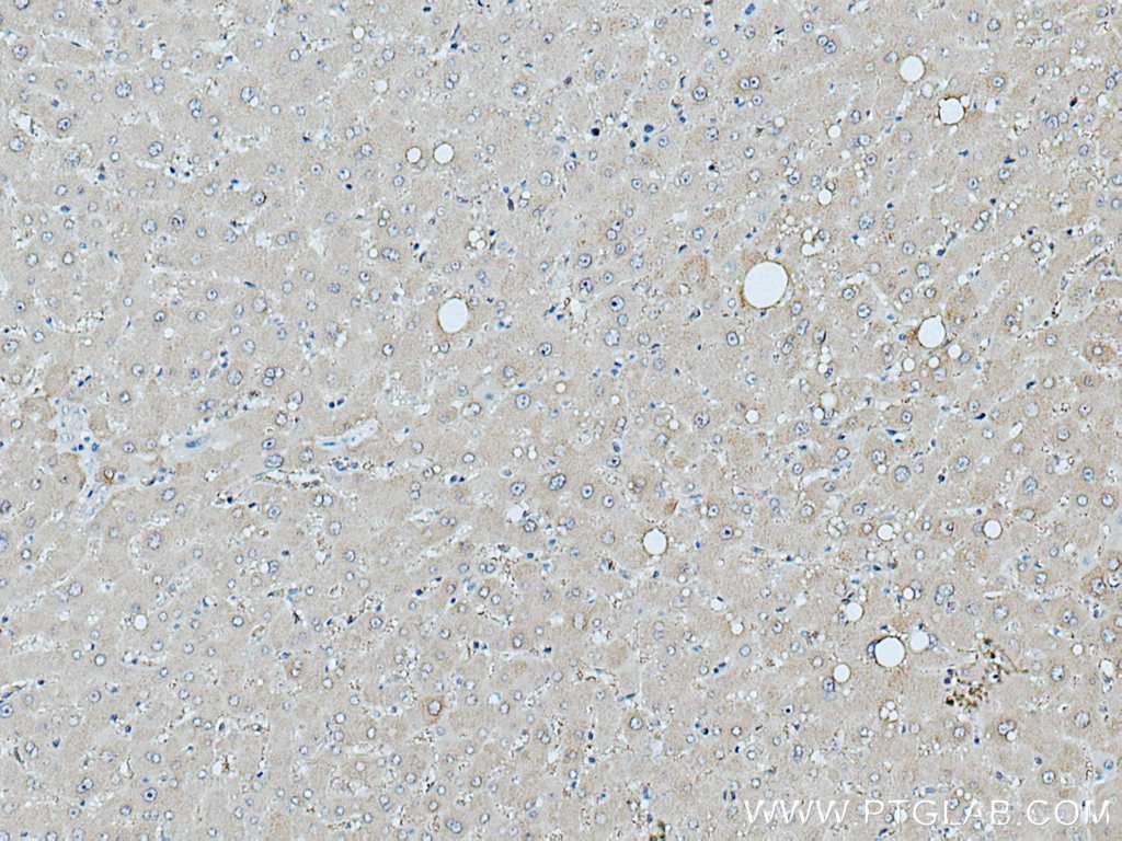 IHC staining of human liver using 10869-1-AP