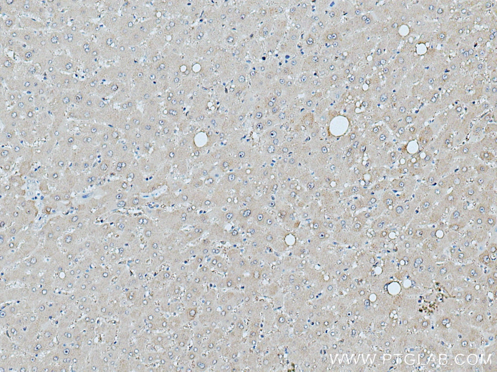 Immunohistochemistry (IHC) staining of human liver tissue using ARMET Polyclonal antibody (10869-1-AP)