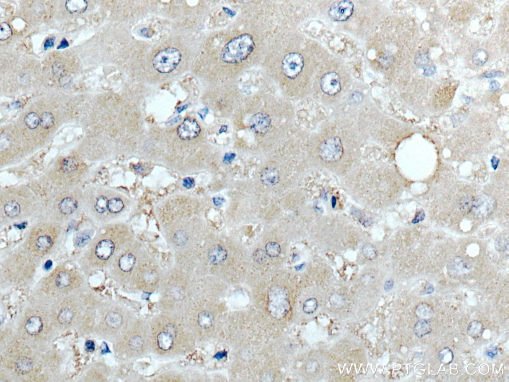 Immunohistochemistry (IHC) staining of human liver tissue using ARMET Polyclonal antibody (10869-1-AP)