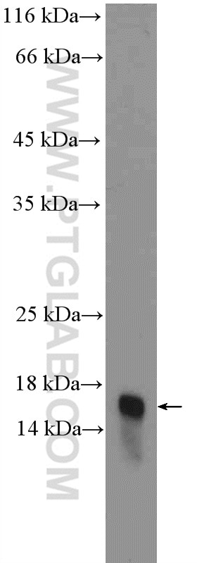 WB analysis of mouse pancreas using 10869-1-AP