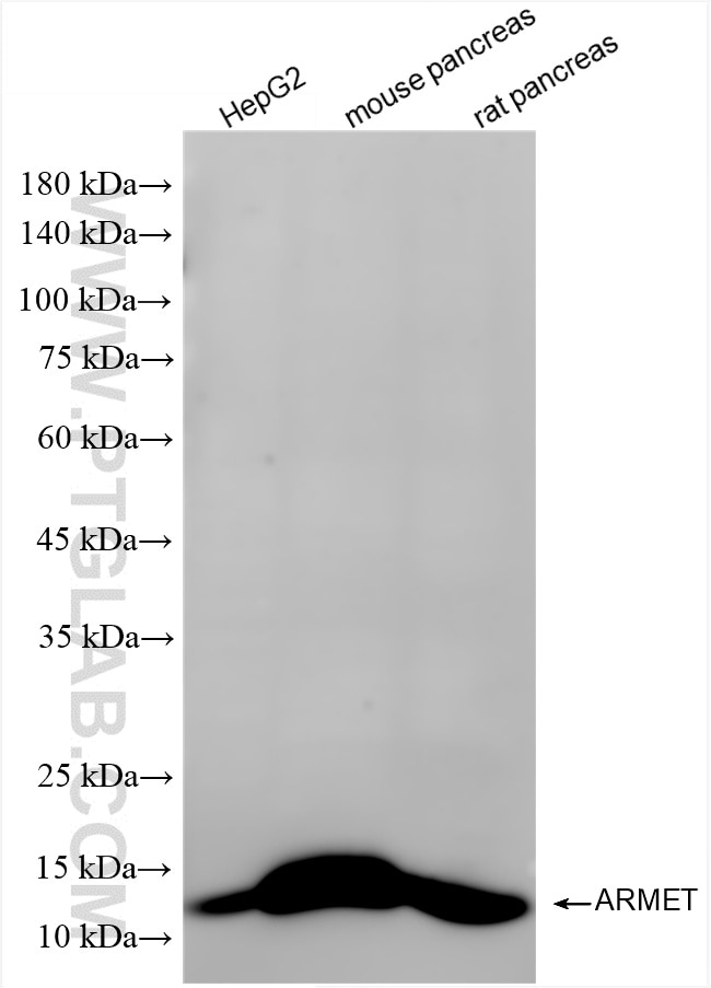 Western Blot (WB) analysis of various lysates using ARMET Recombinant antibody (86360-2-RR)