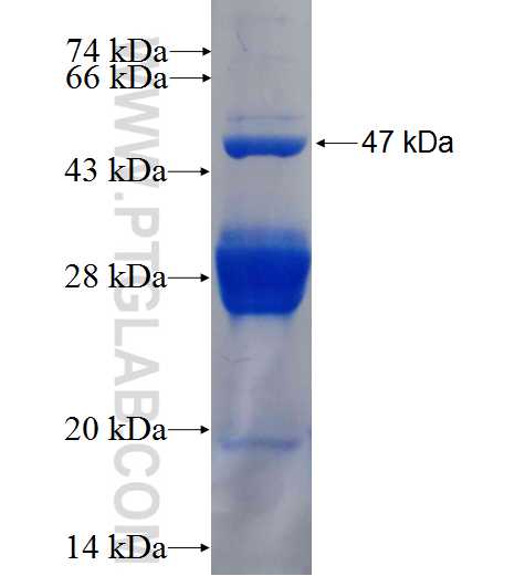 ARMET fusion protein Ag1115 SDS-PAGE