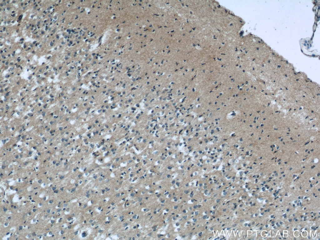 IHC staining of human brain using 25035-1-AP