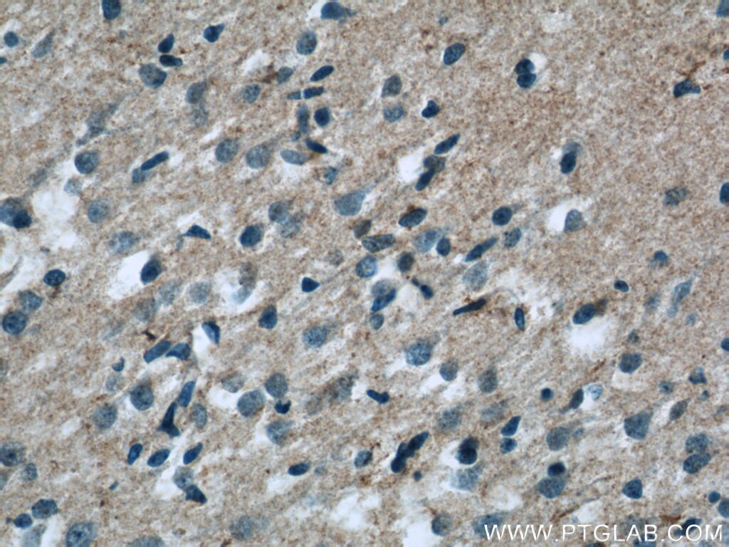 IHC staining of human brain using 25035-1-AP