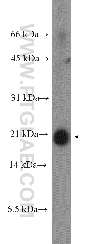 Western Blot (WB) analysis of mouse testis tissue using ARMETL1 Polyclonal antibody (25035-1-AP)