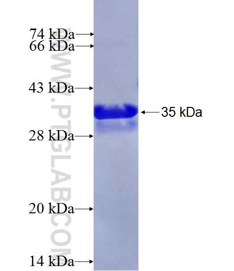 ARMETL1 fusion protein Ag28341 SDS-PAGE