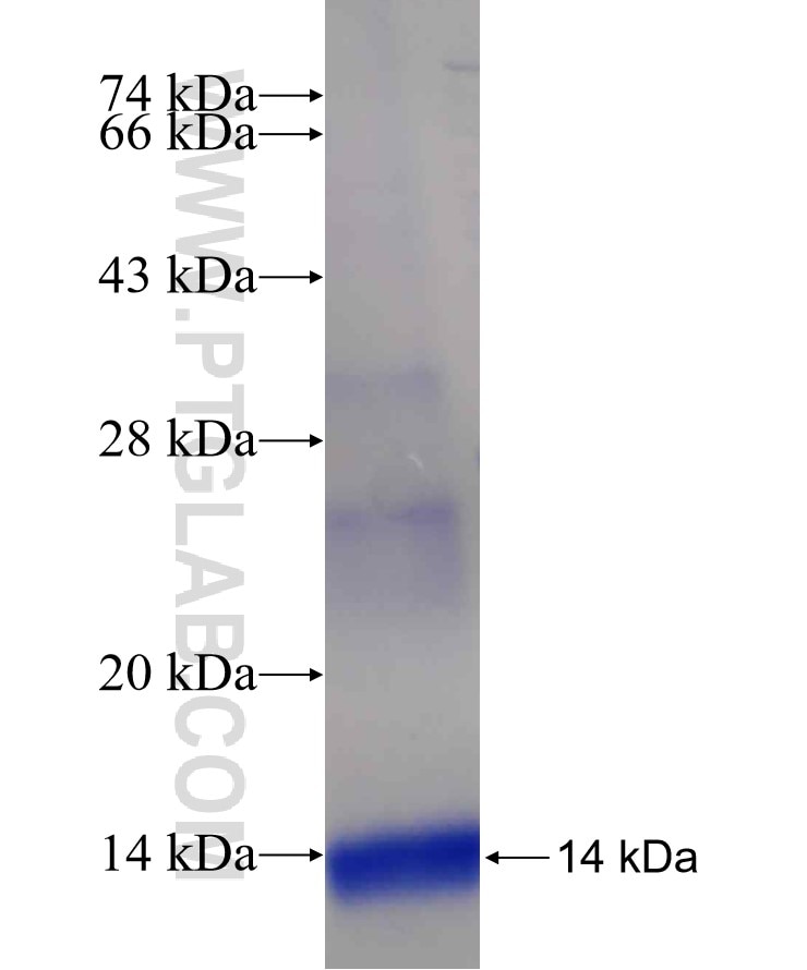 ARMETL1 fusion protein Ag18972 SDS-PAGE