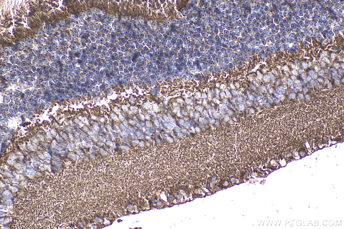 IHC staining of mouse eye using 33334-1-AP Immunohistochemistry (IHC) staining of mouse eye tissue using ARMS2 Polyclonal antibody (33334-1-AP)