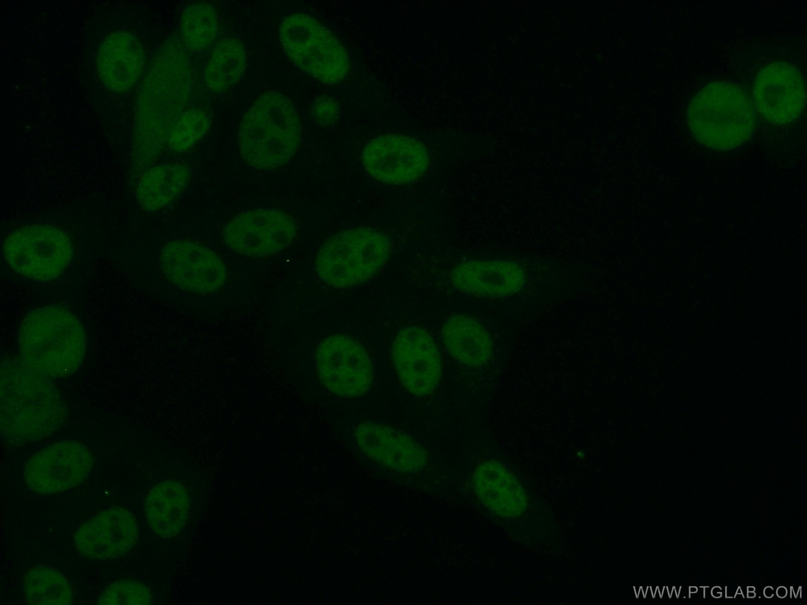 Immunofluorescence (IF) / fluorescent staining of HepG2 cells using ARNT,HIF1B Polyclonal antibody (14105-1-AP)