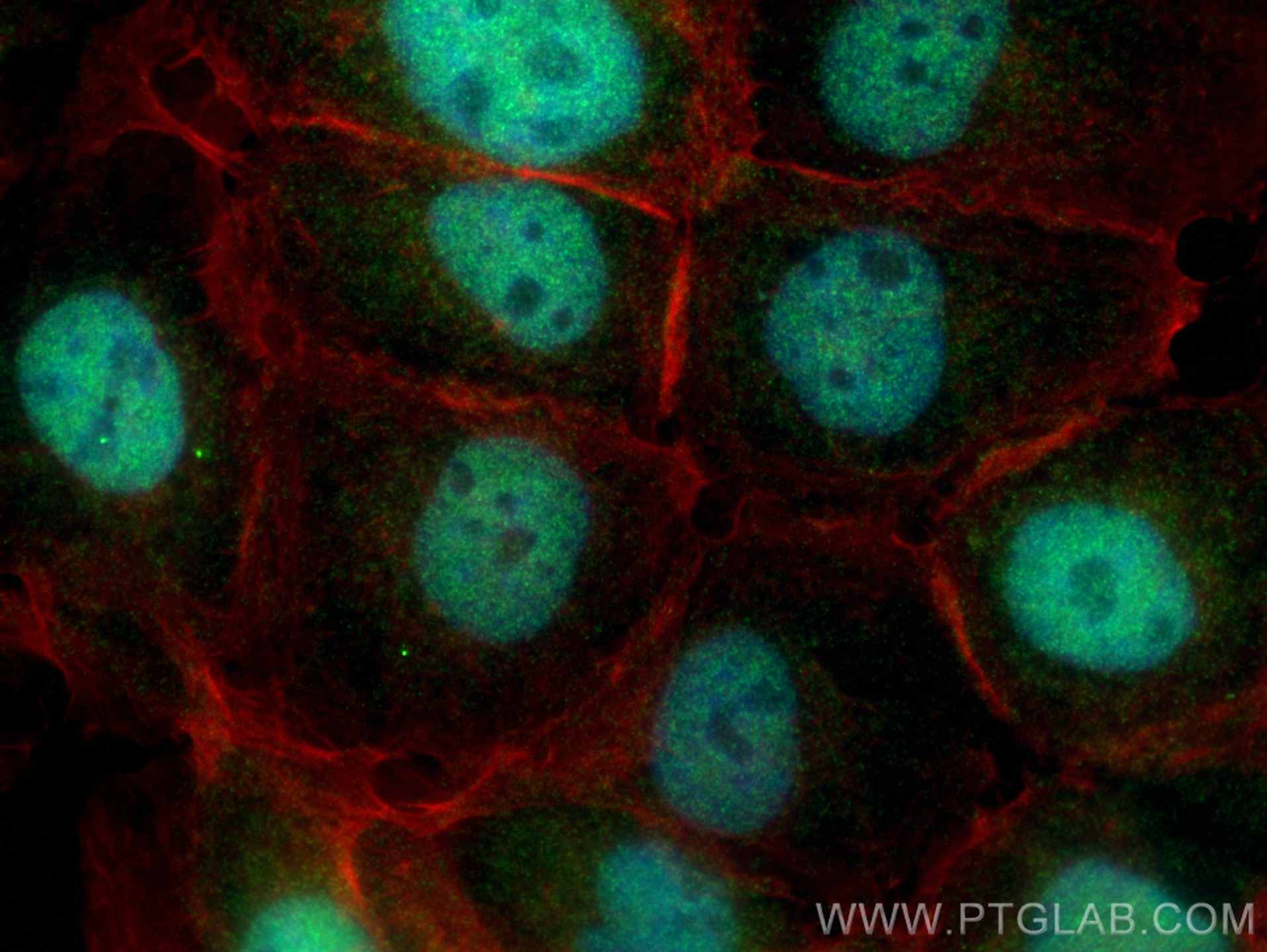 Immunofluorescence (IF) / fluorescent staining of A431 cells using ARNT/HIF-1 beta Polyclonal antibody (14105-1-AP)