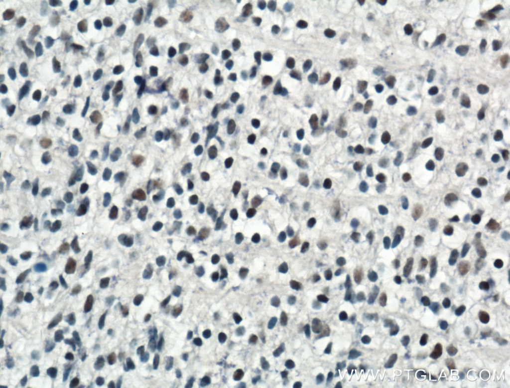 Immunohistochemistry (IHC) staining of mouse embryo tissue using ARNT,HIF1B Polyclonal antibody (14105-1-AP)