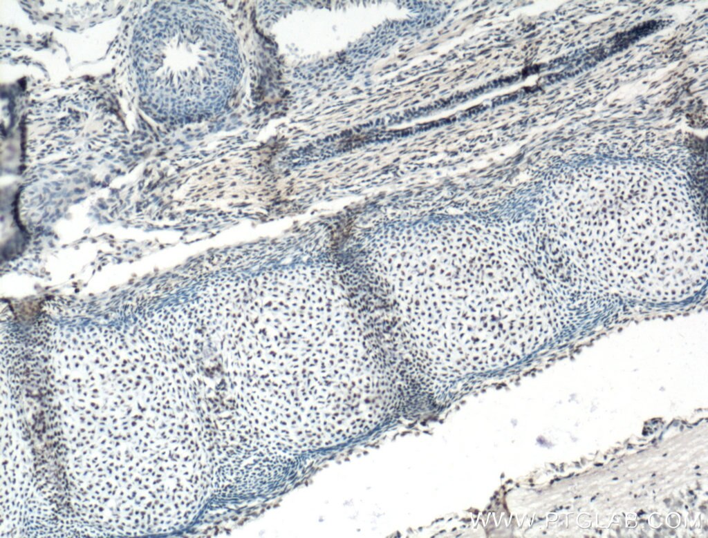 Immunohistochemistry (IHC) staining of mouse embryo tissue using ARNT,HIF1B Polyclonal antibody (14105-1-AP)