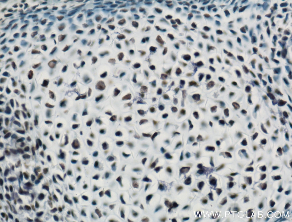 Immunohistochemistry (IHC) staining of mouse embryo tissue using ARNT,HIF1B Polyclonal antibody (14105-1-AP)