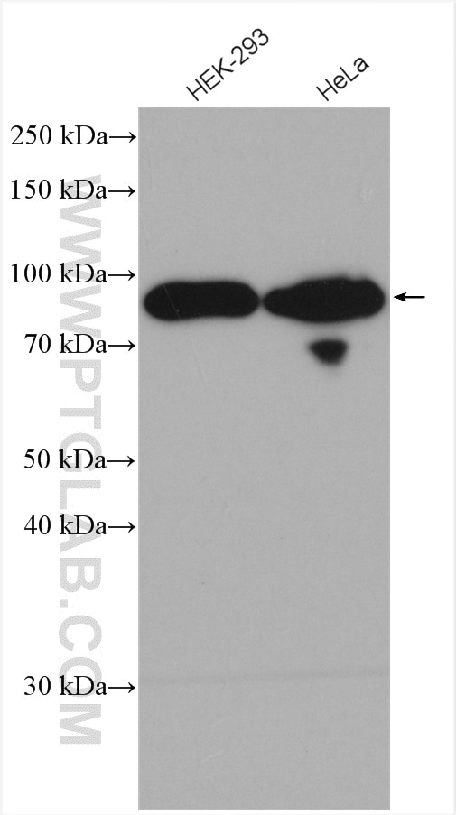Western Blot (WB) analysis of various lysates using ARNT,HIF1B Polyclonal antibody (14105-1-AP)