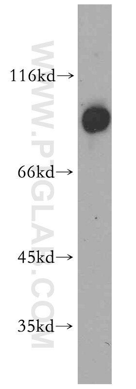 WB analysis of HepG2 using 14105-1-AP