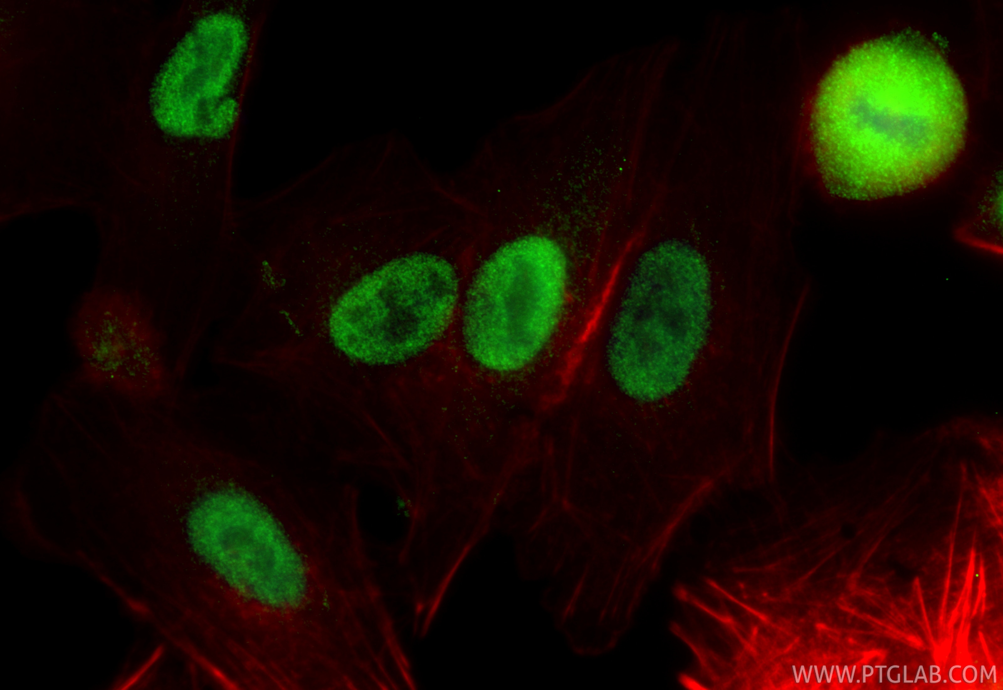 Immunofluorescence (IF) / fluorescent staining of A549 cells using ARNT/HIF-1 beta Monoclonal antibody (66732-1-Ig)